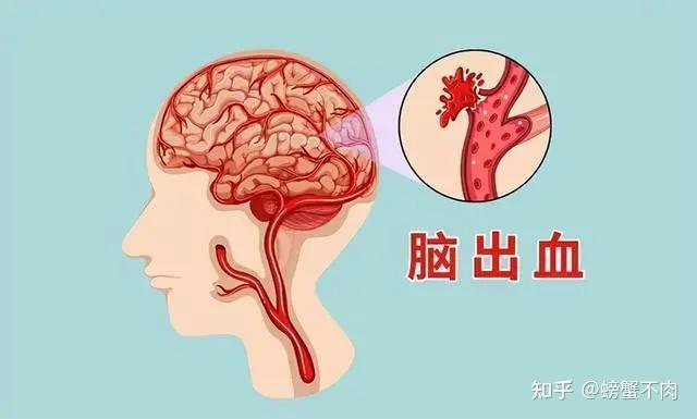 高血压的危害你注意了吗？